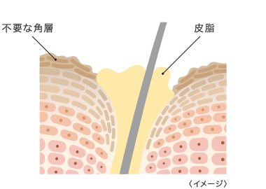 脂っぽい肌の肌断面イメージ