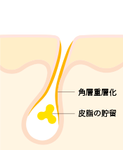 つまらない博士の つまらないお話 Ipsa 公式サイト つまらない博士の つまらないお話 Ipsa 公式サイト