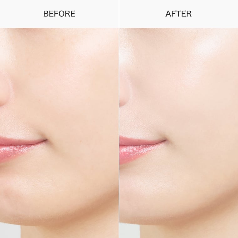 BEFORE AFTER